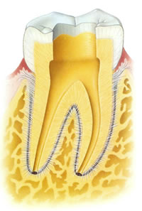 realizacion endodoncias por especialistas dentales